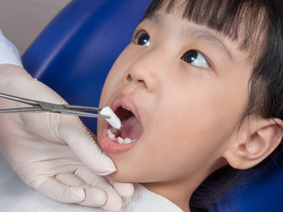 The cost of a childs tooth extraction